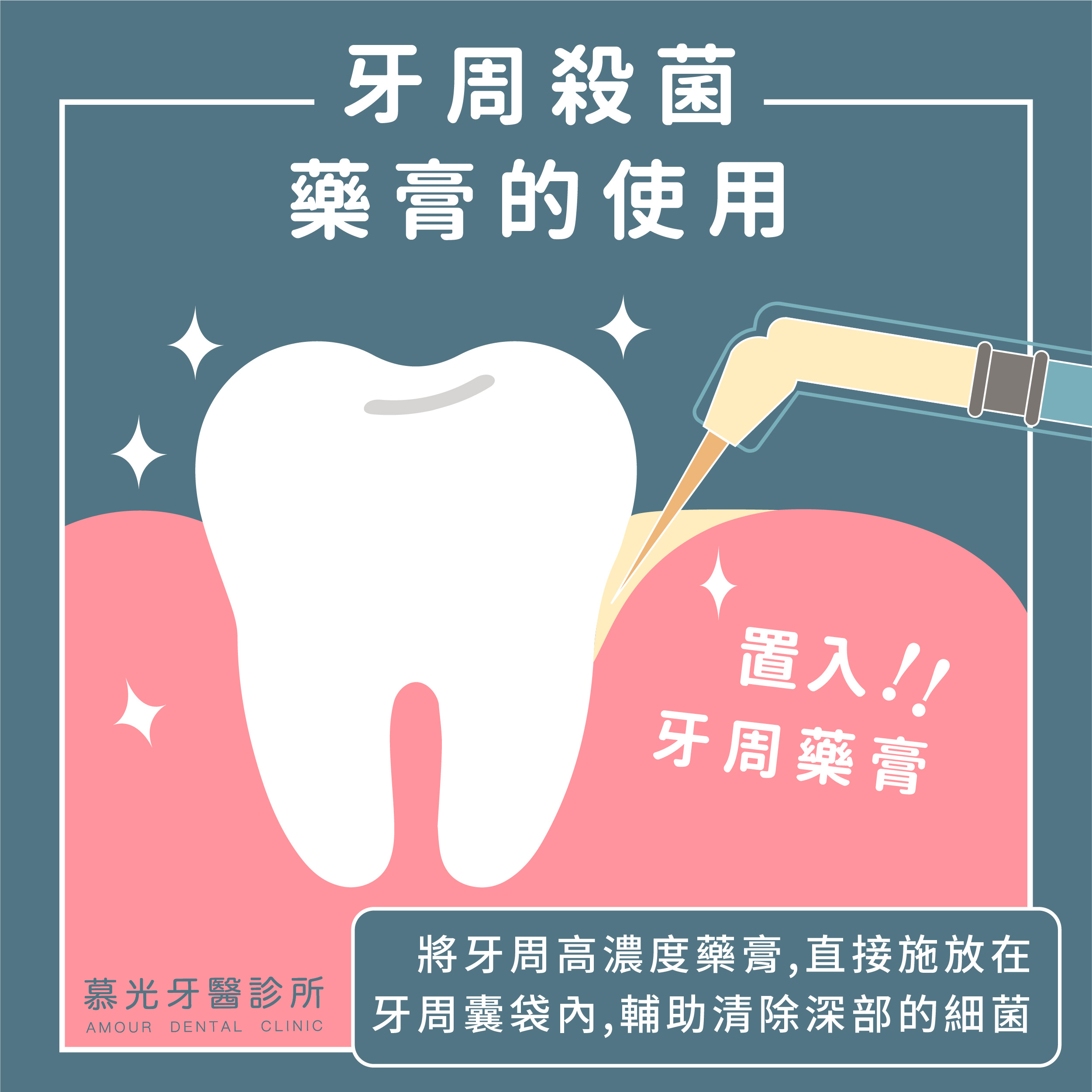 牙周微創手術+牙周抗生素凝膠｜副院長 林國義 醫師 - 慕光牙醫診所 台北中山區