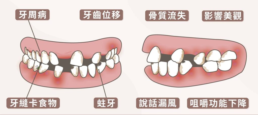 爛牙拖著不處理的 7 種真實後果