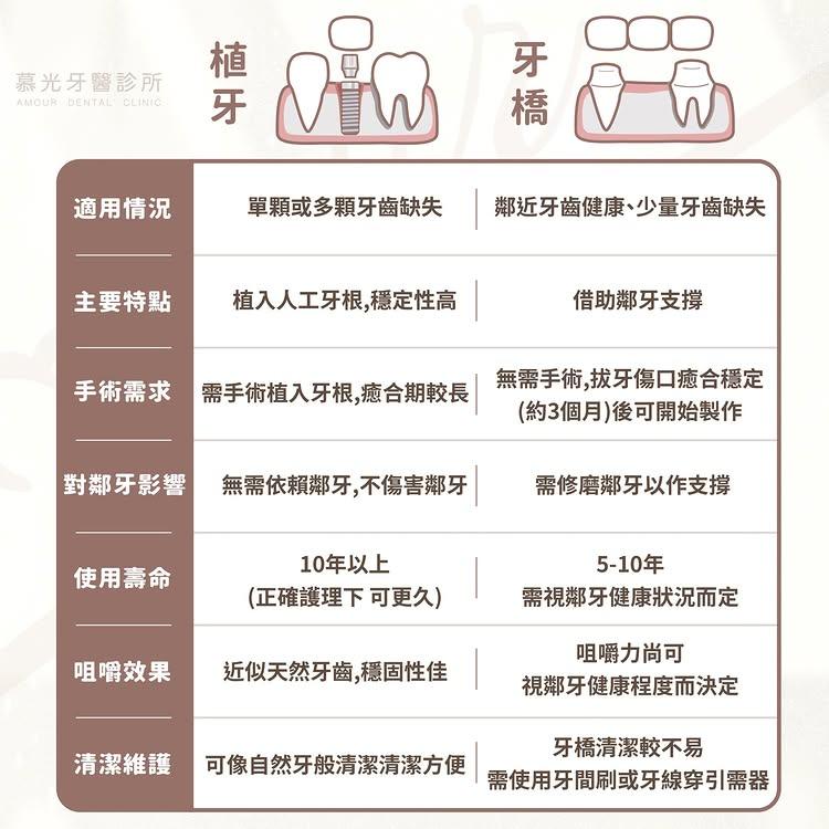 牙橋 v.s. 植牙優缺點比較表
